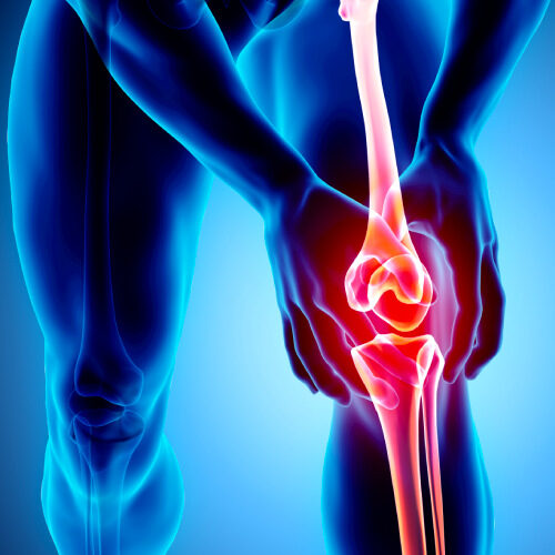 san diego naturopathic doctors 3d render knee joint pain glow