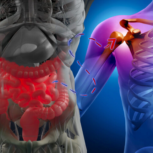 san diego naturopathic doctors 3d rendering of connection bwtween gut and joint