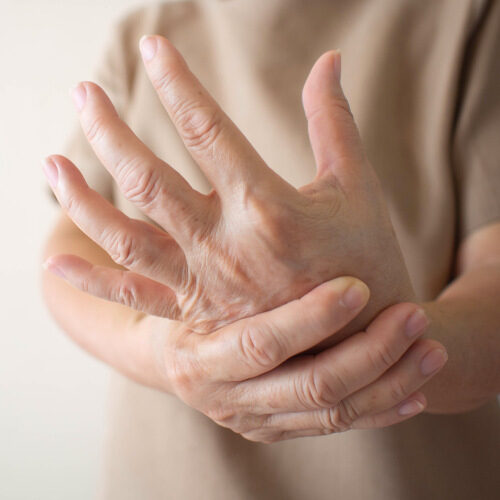 san diego naturopathic doctors hand clasping hand in arthritis pain