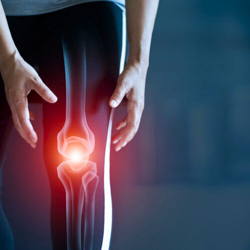 san diego naturopathic doctors overlay render bone knee joint pain glow