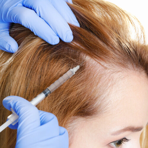 san diego naturopathic doctors woman receiving prp hair restoration injection