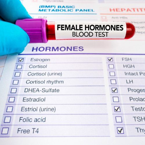 san diego naturopathic doctors female hormones blood test tube