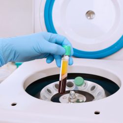 san diego naturopathic doctors prp vial inserted into centrifuge