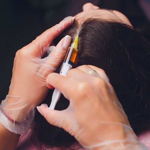 san diego naturopathic doctors woman prp therapy injection for hair loss in woman